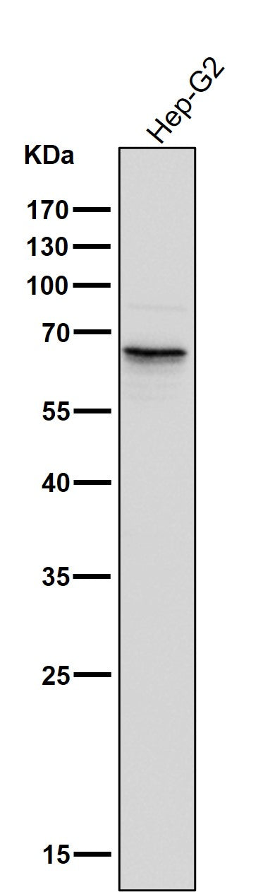 Anti-Phospho-PAK1/2/3 (S144+S141+S139) PAK3 Rabbit Monoclonal Antibody Boster Bio