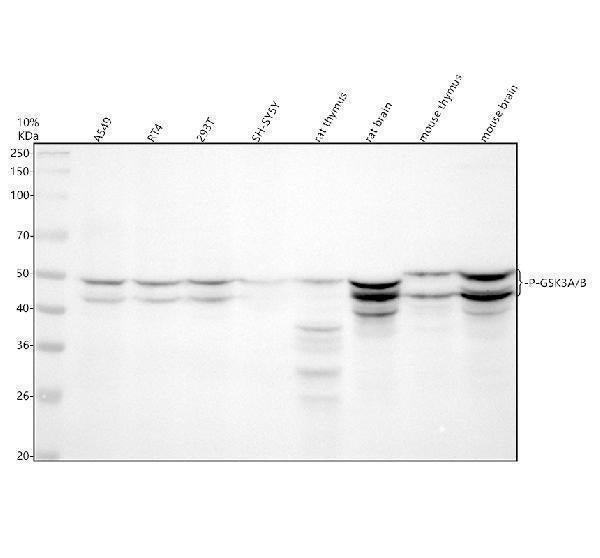 Anti-Phospho-GSK3 (alpha + beta) (Y216 + Y279) GSK3A Rabbit Monoclonal Antibody Boster Bio