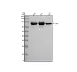 Anti-Phospho-Glycogen synthase 1 (S641) GYS1 Rabbit Monoclonal Antibody Boster Bio