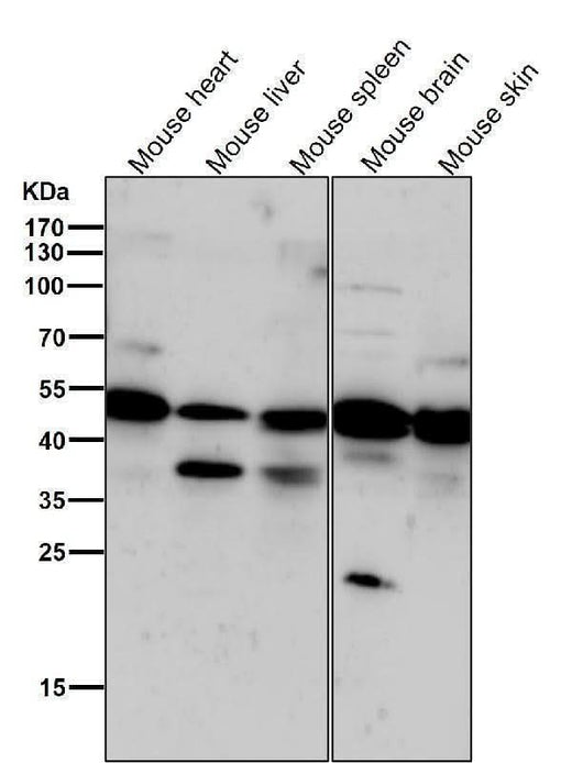 Anti-Phospho-PKA R2 (S99) PRKAR2A Rabbit Monoclonal Antibody Boster Bio