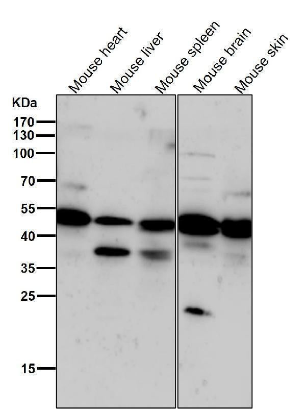 Anti-Phospho-PKA R2 (S99) PRKAR2A Rabbit Monoclonal Antibody Boster Bio