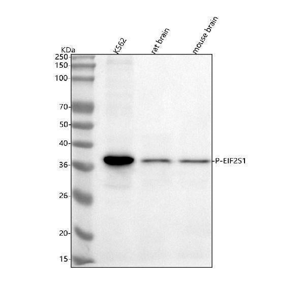 Anti-Phospho-EIF2S1 (S51) Rabbit Monoclonal Antibody Boster Bio