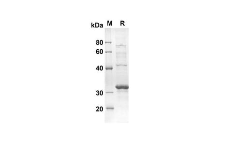 SDS-PAGE analysis of Mouse RETN proteins, 2 μg/lane of Recombinant Mouse RETN proteins was resolved with an SDS-PAGE under reducing conditions, showing bands at 30.2 kDa.
