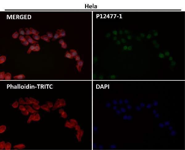 Anti-Histone H3 (acetyl K56) HIST1H3A Rabbit Monoclonal Antibody Boster Bio