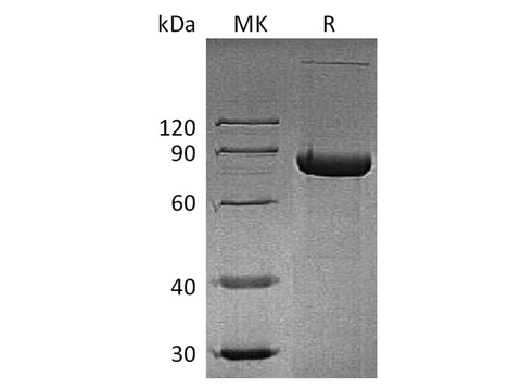 Recombinant Human CD4/LEU3 Protein (Fc Tag) - ABMIUM