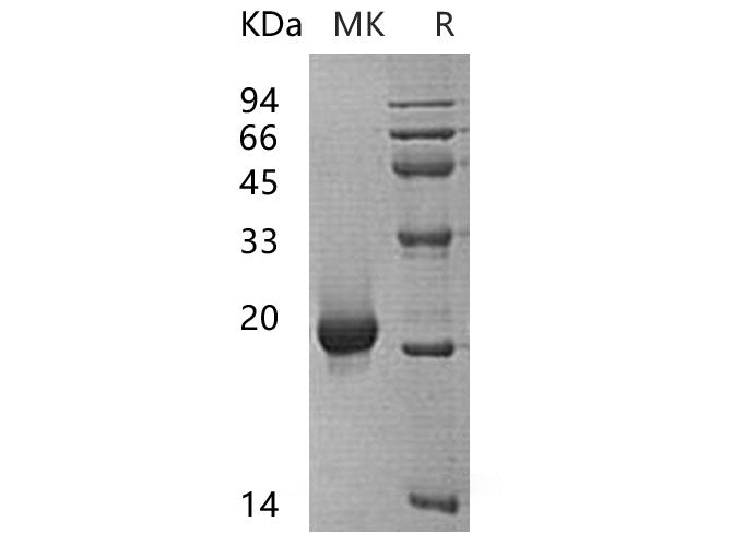 Recombinant Human SENP7 Protein - ABMIUM