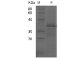 SDS-PAGE analysis of Human MUC5AC proteins, 2 μg/lane of Recombinant Human MUC5AC proteins was resolved with SDS-PAGE under reducing conditions, showing bands at 35 kDa.