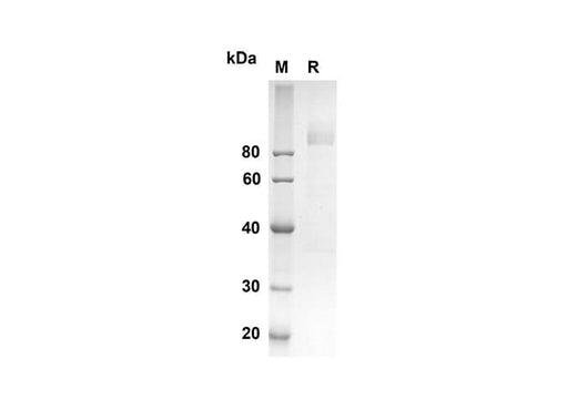 SDS-PAGE analysis of Mouse Cd36 proteins, 2 μg/lane of Recombinant Mouse Cd36 proteins was resolved with an SDS-PAGE under reducing conditions, showing bands at 69.9 kDa.
