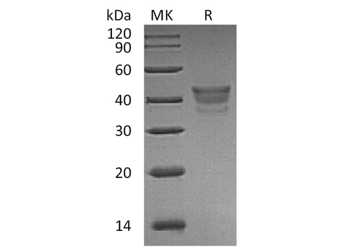 Recombinant Human METAP1 Protein - ABMIUM
