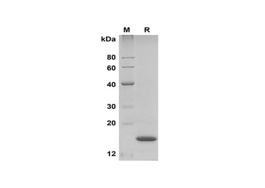 SDS-PAGE analysis of Human IFNα2 proteins, 2 μg/lane of Recombinant Human IFNα2 proteins was resolved with SDS-PAGE under reducing conditions, showing bands at 15 kDa.