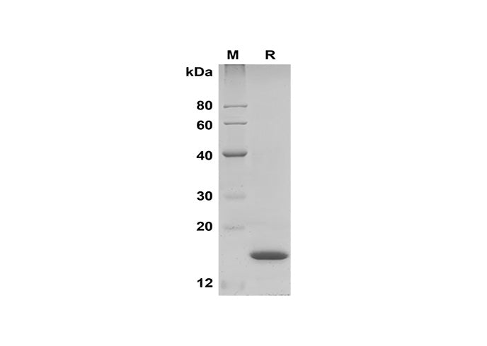 SDS-PAGE analysis of Human IFNα2 proteins, 2 μg/lane of Recombinant Human IFNα2 proteins was resolved with SDS-PAGE under reducing conditions, showing bands at 15 kDa.
