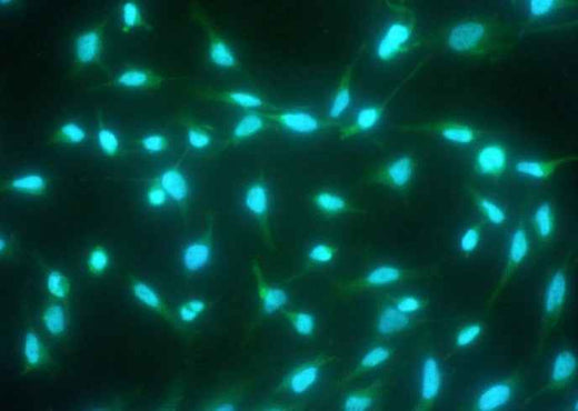 Anti-Human CASP14 Antibody [A1143] - ABMIUM