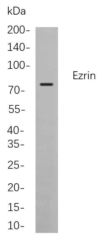 Anti-Human/Mouse/Rat Ezrin Antibody [B828] - ABMIUM