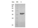 Recombinant Human ECH1 Protein - ABMIUM