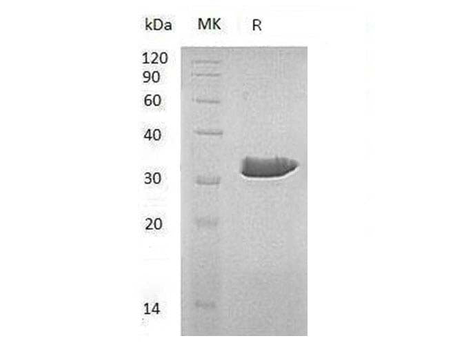 Recombinant Human ECH1 Protein - ABMIUM