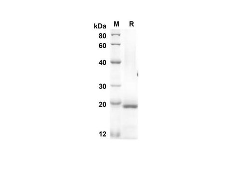 SDS-PAGE analysis of Mouse ESM1 proteins, 2 μg/lane of Recombinant Mouse ESM1 proteins was resolved with an SDS-PAGE under reducing conditions, showing bands at 17.8 kDa.