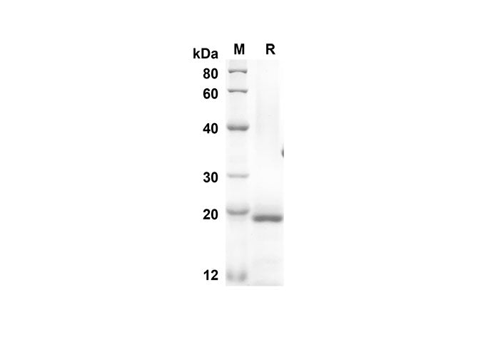 SDS-PAGE analysis of Mouse ESM1 proteins, 2 μg/lane of Recombinant Mouse ESM1 proteins was resolved with an SDS-PAGE under reducing conditions, showing bands at 17.8 kDa.