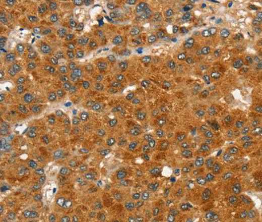 Anti-Human/Mouse/Rat RASA3 Antibody