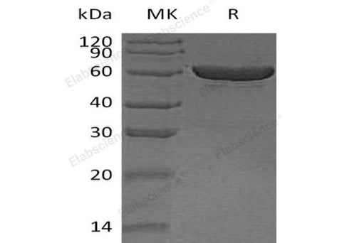 Recombinant Human Carboxylesterase 1/CES1 Protein (His Tag) - ABMIUM