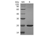 Recombinant Human GABARAPL1 Protein (His Tag) - ABMIUM