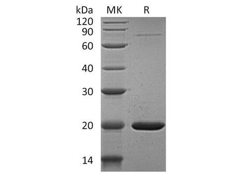 Recombinant Human GABARAPL1 Protein (His Tag) - ABMIUM