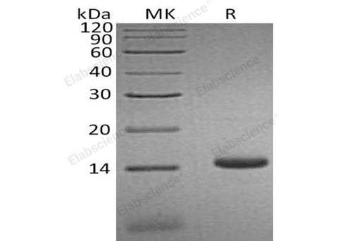 Recombinant Human CCL3L1 Protein (His Tag) - ABMIUM