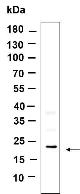 Anti-Human/Mouse/Rat TXD12 Antibody [B875] - ABMIUM