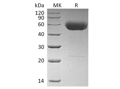 Recombinant Human Interleukin-22/IL-22 Protein (C-hIgG2 Fc) - ABMIUM