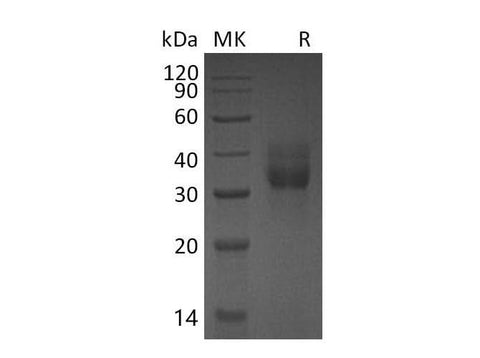 Recombinant Mouse Cathepsin B/CTSB Protein (His Tag) - ABMIUM