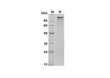SDS-PAGE analysis of Rat LDLR proteins, 2 μg/lane of Recombinant Rat LDLR proteins was resolved with SDS-PAGE under reducing conditions, showing bands at 100 kDa.