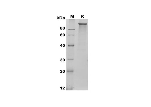 SDS-PAGE analysis of Rat LDLR proteins, 2 μg/lane of Recombinant Rat LDLR proteins was resolved with SDS-PAGE under reducing conditions, showing bands at 100 kDa.