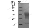 Recombinant Mouse LAIR1 Protein (aa 22-141, His Tag) - ABMIUM