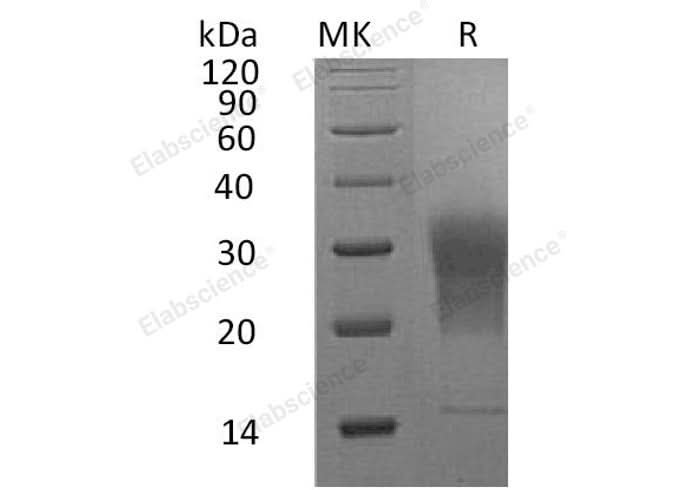 Recombinant Mouse LAIR1 Protein (aa 22-141, His Tag) - ABMIUM