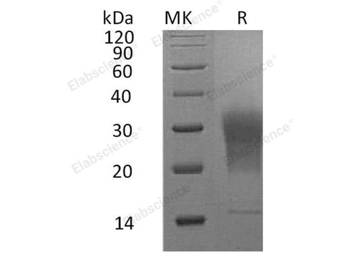 Recombinant Mouse LAIR1 Protein (aa 22-141, His Tag) - ABMIUM
