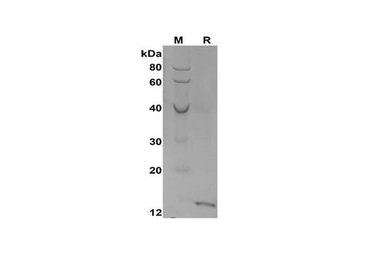 SDS-PAGE analysis of Human CXCL10 proteins,2 μg/lane of Recombinant Human CXCL10 proteins,was resolved with SDS-PAGE under reducing conditions,showing bands at 13 kDa.
