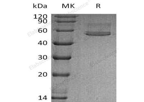 Recombinant Human Chitotriosidase/CHIT1 Protein (His Tag) - ABMIUM