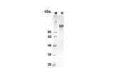 SDS-PAGE analysis of Mouse Cd163 proteins, 2 μg/lane of Recombinant Mouse Cd163 proteins was resolved with an SDS-PAGE under reducing conditions, showing bands at 135.6 kDa.