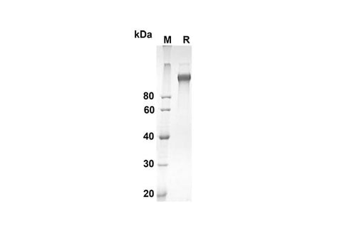 SDS-PAGE analysis of Mouse Cd163 proteins, 2 μg/lane of Recombinant Mouse Cd163 proteins was resolved with an SDS-PAGE under reducing conditions, showing bands at 135.6 kDa.