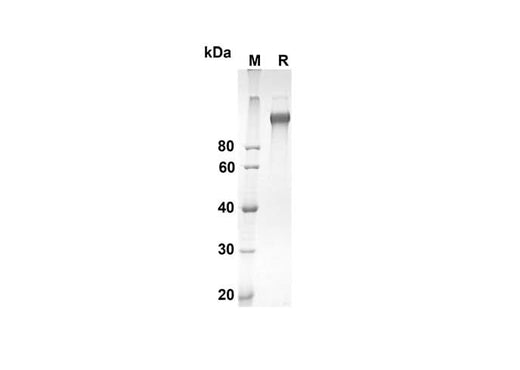 SDS-PAGE analysis of Mouse Cd163 proteins, 2 μg/lane of Recombinant Mouse Cd163 proteins was resolved with an SDS-PAGE under reducing conditions, showing bands at 135.6 kDa.