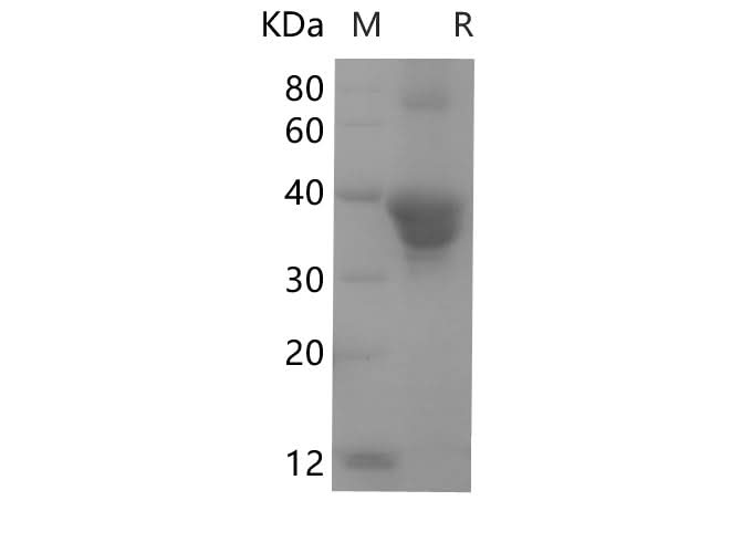 SDS-PAGE analysis of Human POSTN proteins, 2 μg/lane of Recombinant Human POSTN proteins was resolved with SDS-PAGE under reducing conditions, showing bands at 40.3 kDa.