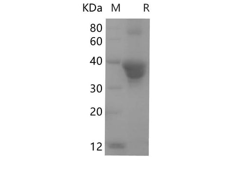 SDS-PAGE analysis of Human POSTN proteins, 2 μg/lane of Recombinant Human POSTN proteins was resolved with SDS-PAGE under reducing conditions, showing bands at 40.3 kDa.