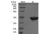 Recombinant Human SENP2 Protein - ABMIUM