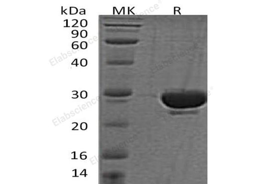 Recombinant Human SENP2 Protein - ABMIUM