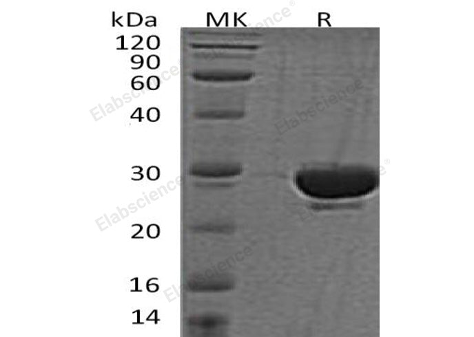 Recombinant Human SENP2 Protein - ABMIUM