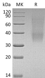 Recombinant Mouse SLAMF9 Protein (His Tag) - ABMIUM