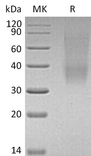 Recombinant Mouse SLAMF9 Protein (His Tag) - ABMIUM