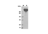 SDS-PAGE analysis of Human RET proteins, 2 μg/lane of Recombinant Human RET proteins was resolved with SDS-PAGE under reducing conditions, showing bands at 90-120 kDa.