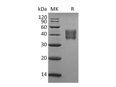 Recombinant Human SLAMF5/CD84 Protein (aa 22-220, His Tag) - ABMIUM