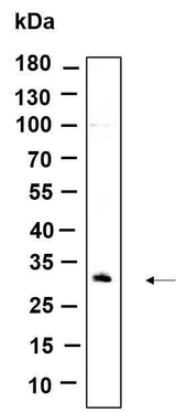 Anti-Human/Mouse/Rat CDIN1 Antibody [B964]