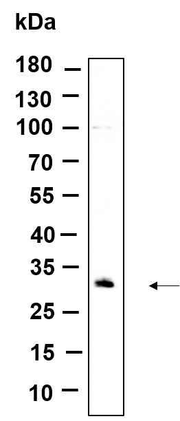 Anti-Human/Mouse/Rat CDIN1 Antibody [B964]